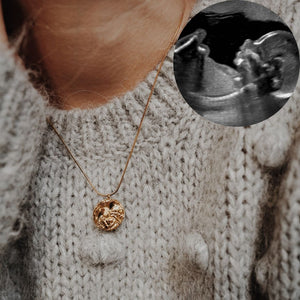 Custom ultrasound pendant necklace – personalised pregnancy keepsake jewelry handcrafted from your baby’s ultrasound scan image in sterling silver, gold-plated, or solid gold.