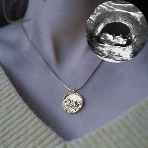 Custom ultrasound pendant necklace – personalised pregnancy keepsake jewelry handcrafted from your baby’s ultrasound scan image in sterling silver, gold-plated, or solid gold.