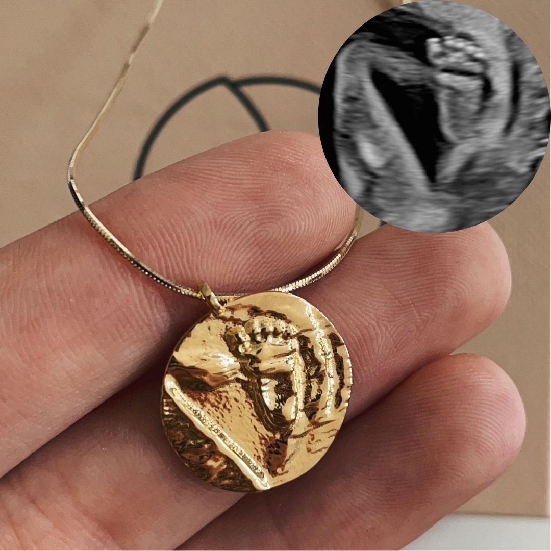 Custom ultrasound pendant necklace – personalised pregnancy keepsake jewelry handcrafted from your baby’s ultrasound scan image in sterling silver, gold-plated, or solid gold.